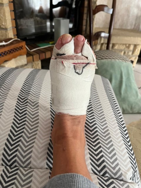 Le pied d'Éric.jpg